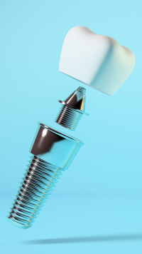 precio implante dental