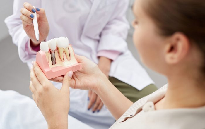 cuidados implantes dentales
