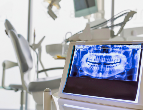 La falta de dientes y pérdida de hueso dental: causas y consecuencias