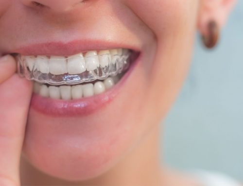 Ortodoncia por segunda vez: todo lo que debes de saber