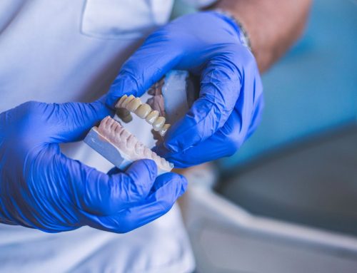 ¿Implantes dentales o prótesis removibles?