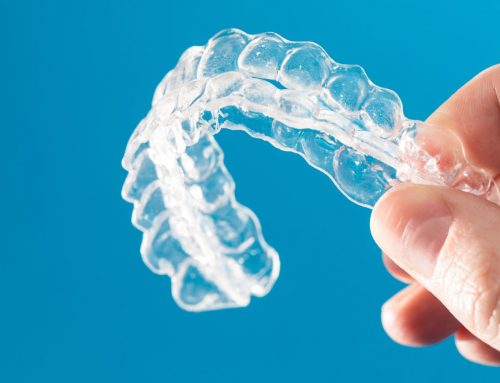 14 Preguntas frecuentes sobre la ortodoncia invisible