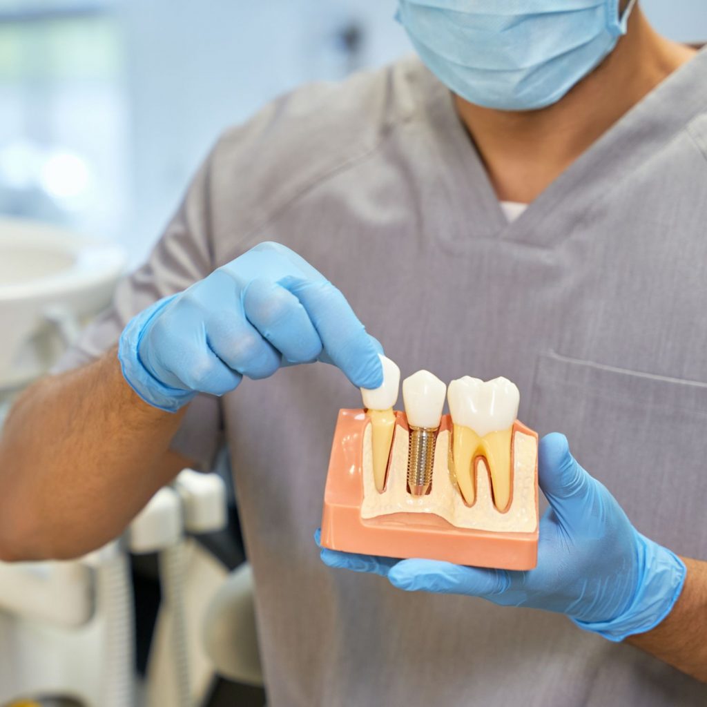 implantes dentales personas mayores