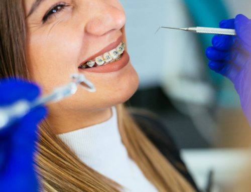 Beneficios y características de la ortodoncia de brackets